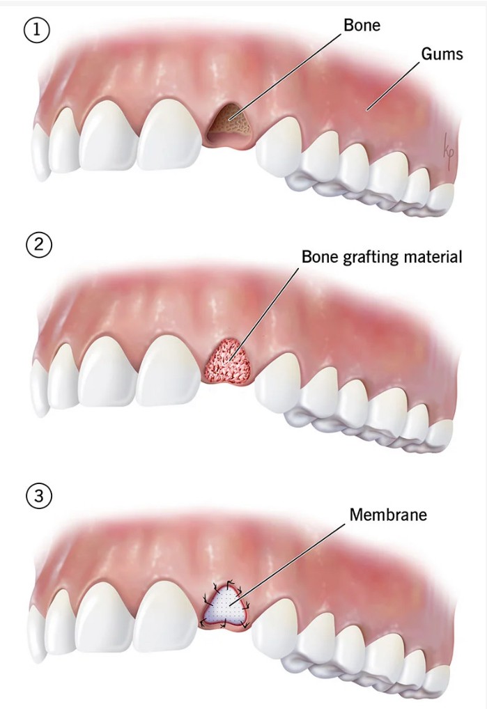 oral surgery