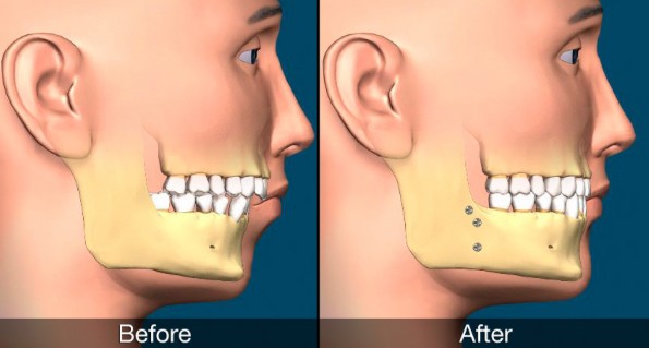 oral surgery